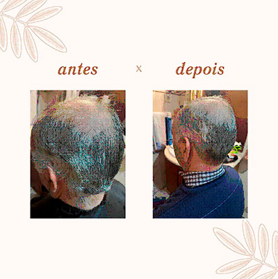 Beleza não tem Idade